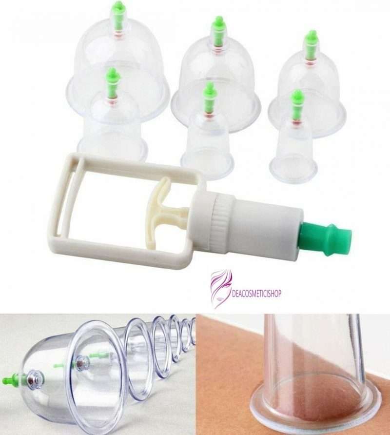 set di coppe in plastica per trattamento coppettazione cupping 6pz
